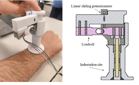 Mechanical Characterization of Healthy Skin and Scar Tissue Using Low-Cost Haptic Measurements